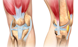 Combat Cartilage Wear Through Movement