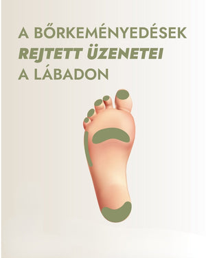 The Hidden Messages of Calluses on Your Feet